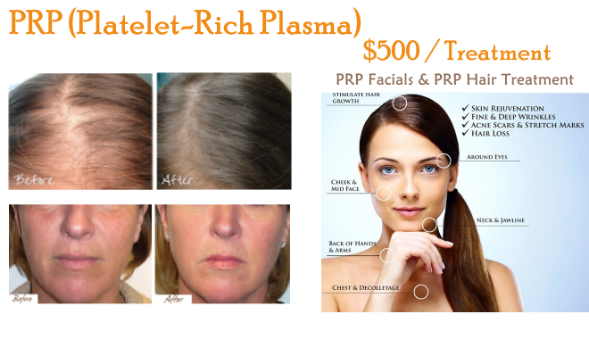 PRP (Platelet-Rich Plasma) - $500 per treatment