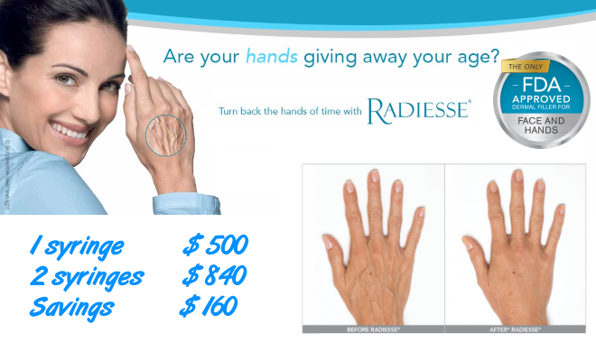 Radiesse Hand Rejuvenation - 1 syringe $500, 2 syringes $840